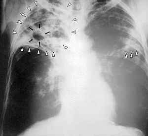 None - This image is in the public domain and ... None - This image is in the public domain and ...
